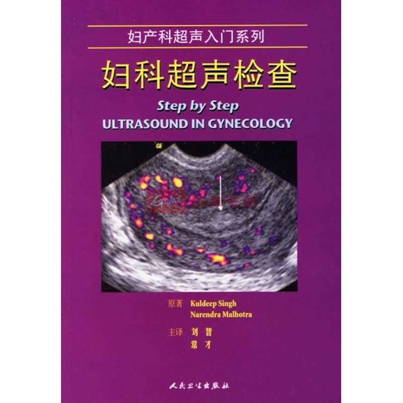 妇科超声检查(翻译版)图片,外观图,细节图